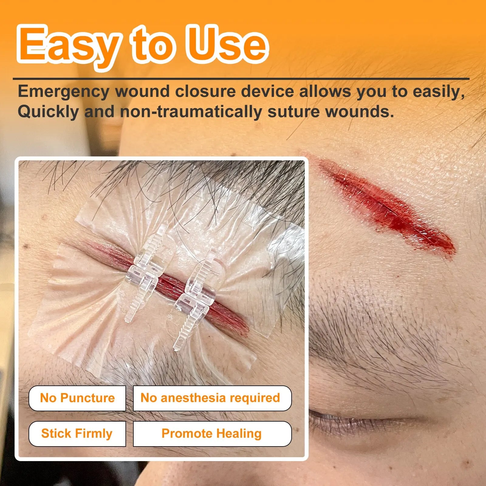 WoundCare™ - Wound Dressing Closure Strip Set