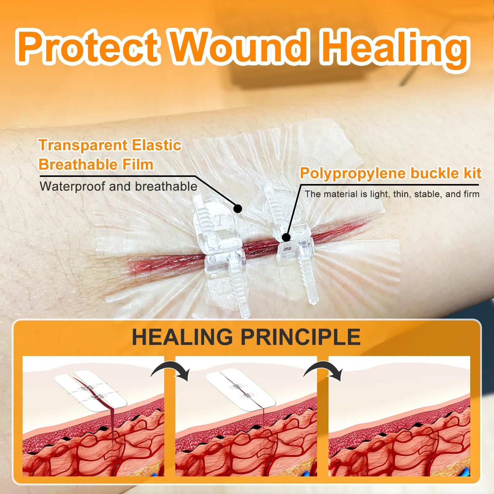 WoundCare™ - Wound Dressing Closure Strip Set