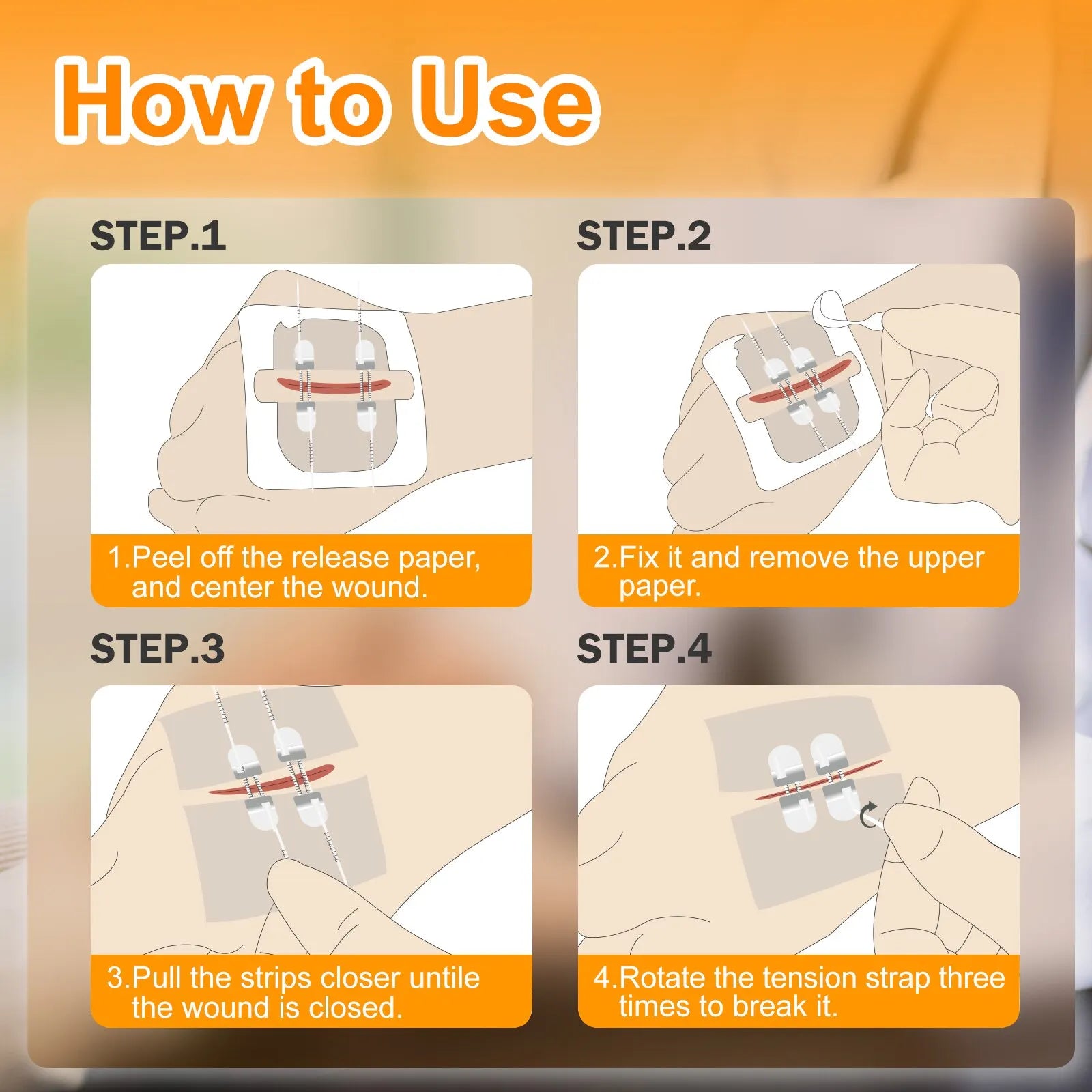 WoundCare™ - Wound Dressing Closure Strip Set